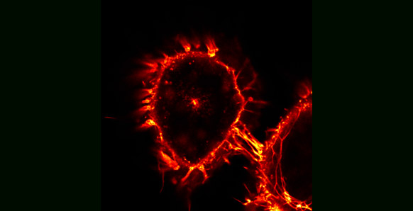 CD95 receptors fused to fluorescent proteins