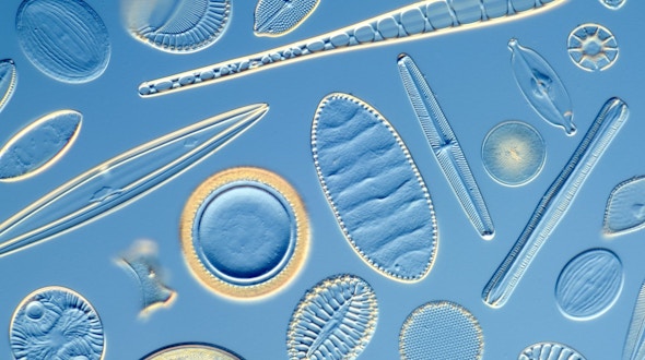 Differential interference contrast light micrograph of a number of different diatoms. Diatoms are single-celled photosynthetic algae.