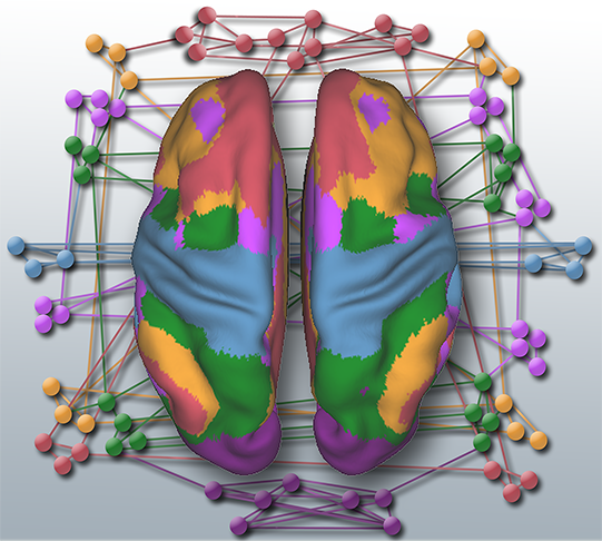 Colorful digital image of brain with networks on the outside of it