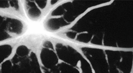 Grayscale brain cell neurons