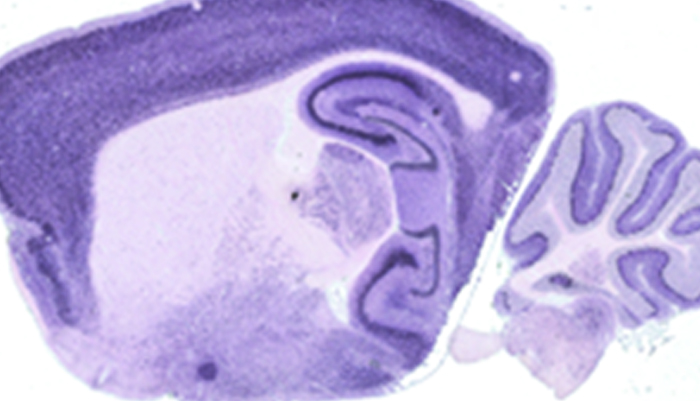 Purple-tinted brain image