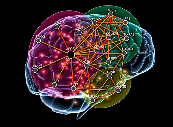 Google admits the human brain still beats an algorithm