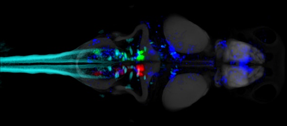 Zebrafish brain activity scan