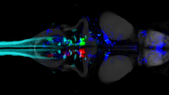 斑马鱼大脑活动扫描