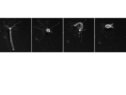 Four images of hydra vulgaris developing