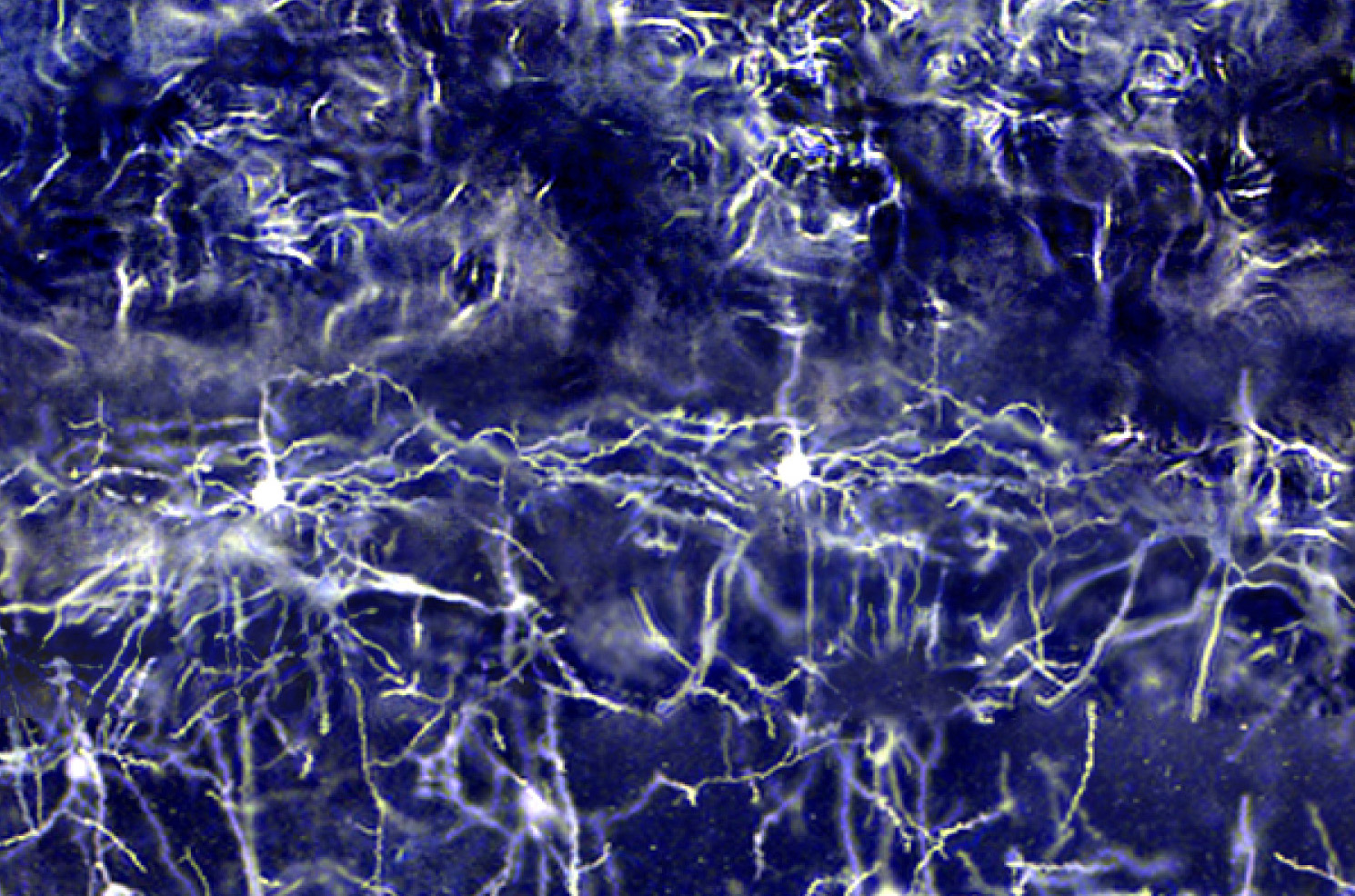 Purple-tinted neurons