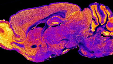 Mice deficient in the gene Rai1 are characteristically obese with learning, memory and balance problems. In normal adult mice, the gene is widely expressed through the brain (yellow marks regions with higher expression).