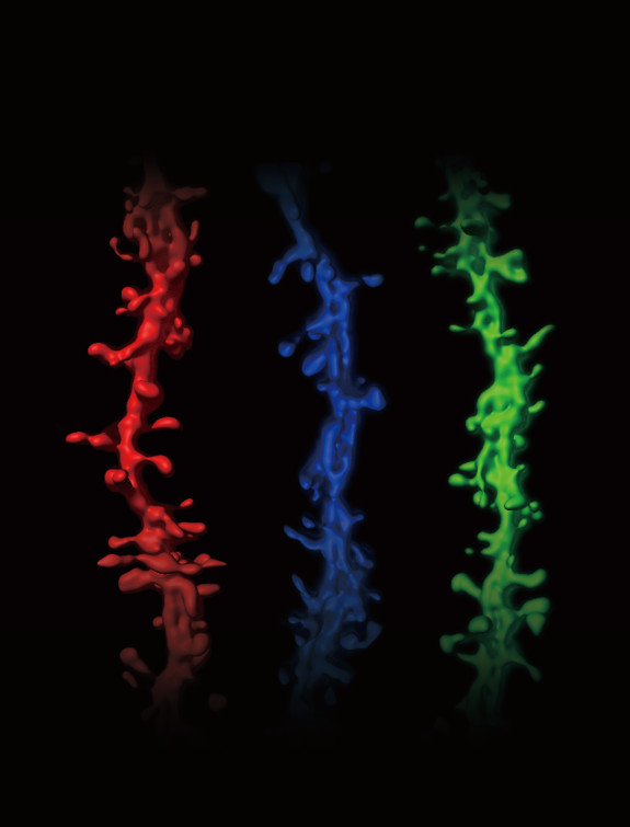 Image of three vertical neurons. Neurons with a mutation have fewer synapses (middle) than typical mice (left), work by Feng and colleagues shows. This synapse deficit can be reversed if the gene gets turned on, even in adulthood (right).