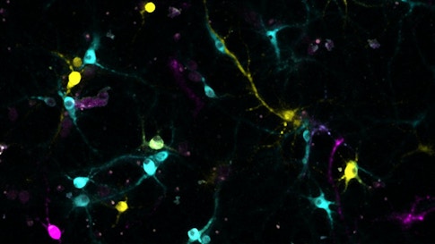 Barcoded neurons being sequenced in situ using BaristaSeq
