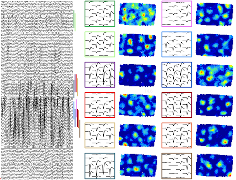 Left: Neural activity recorded from different electrodes within the entorhinal cortrex. Right: Activity patterns for 12 different grid cells recorded simultaneously using Neuropixels