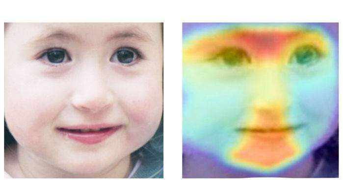 An illustration of using artificial intelligence to diagnose rare disorders. A child's picture is shown on the left while a picture of the same child with colormap superimposed is shown in the right