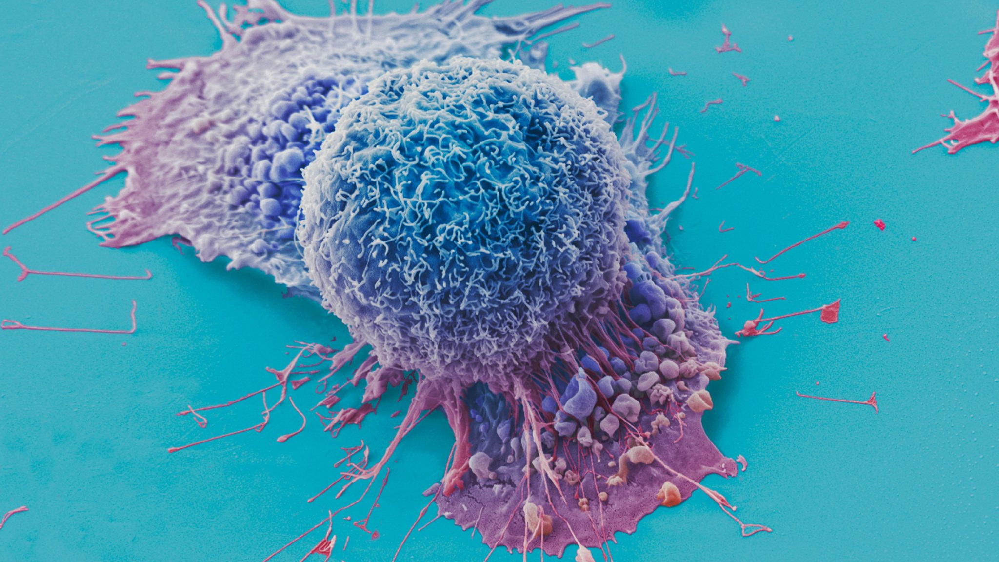 Image of Lung Cancer Cell