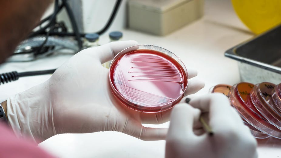 swabbing petri dish