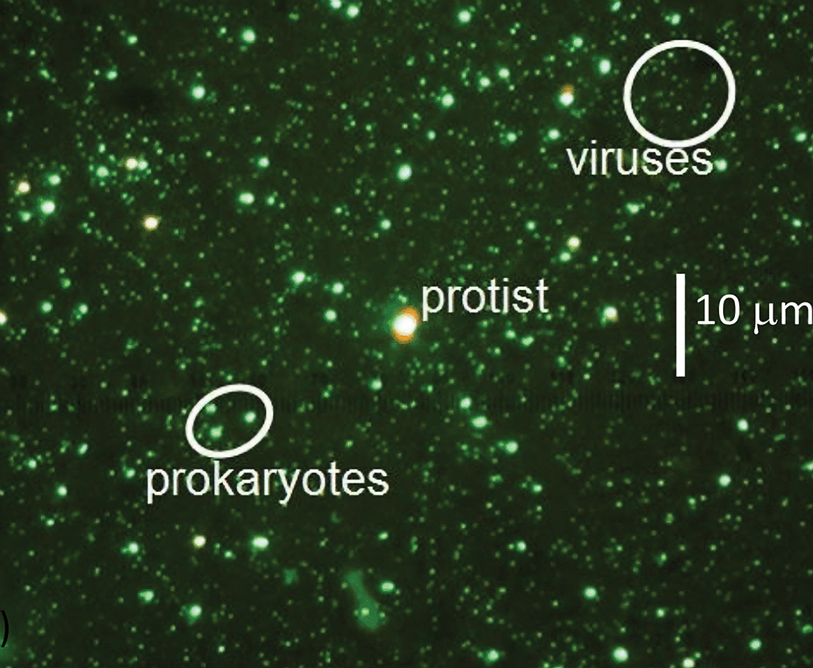IMage of microbes in a drop of ocean water