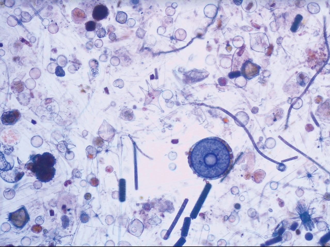 Image of phytoplankton