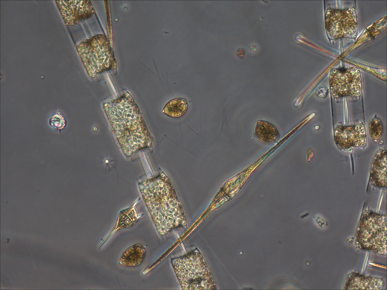 Dinoflagellates a form of marine plankton, coexist with chains of diatoms, glass-shelled organisms that Dutkiewicz calls “the most charismatic” of the marine microbes.