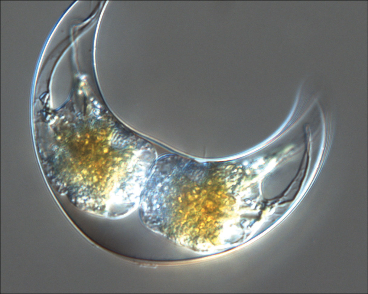 Pyrocystis a kind of dinoflagellate