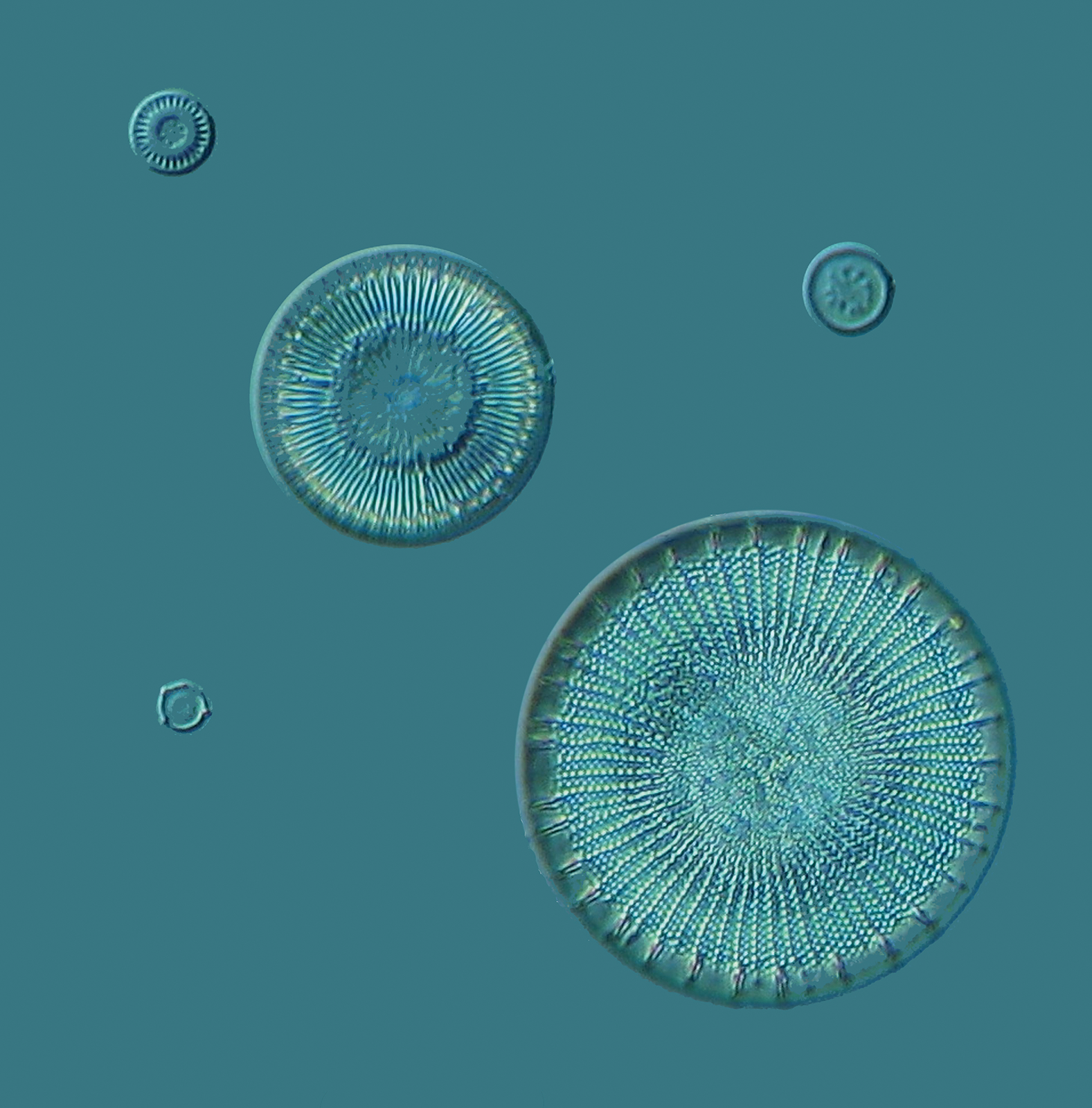 Pillbox-shaped diatoms.