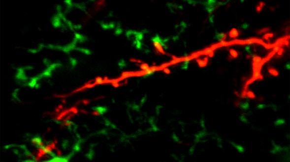 Microglia Spines