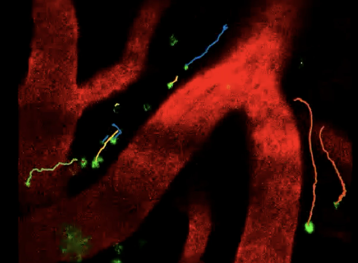 The Good Kind of Brainwashing - Vimarsana News