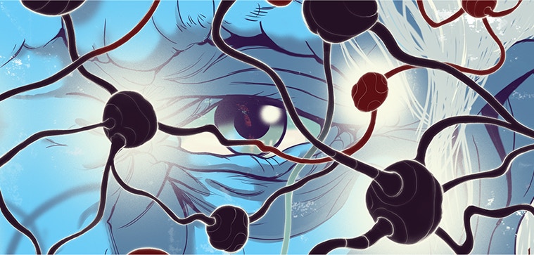 How Clumps of Misshapen Proteins Gum Up Aging Brains