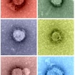 6 grainy photos of coronavirus samples as viewed under a microscope arranged in two columns. The coronavirus cells vary in shape and size, and the photos themselves are tinted different colors. The top-left photo is tinted red and shows a virus circular in shape. The top-right photo is tinted a light-blue-green and shows another circular virus cell. The middle-left photo is tinted a light grayish blue and shows a circular virus with a small dent on its upper-right side. The middle-right photo is tinted yellow and shows a circular virus smaller than the previous three samples. The bottom-left photo is tinted a light-grayish-red and shows a circular virus slightly larger than the previous photo. Finally, the bottom-right photo is tinted a light blue and shows a larger virus with a faint seam beginning from its upper left side and ending at its lower right side. The cell bends inwards at the end points of this seam, as though the photo of this sample caught the virus in the middle of mitosis.