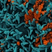 Colorized scanning electron micrograph of a cell, colored teal, infected with SARS-CoV-2 virus particles, which are colored orange. The protrusions of the cell are long and thin, while the virus is represented as clumps of spheres joined together.