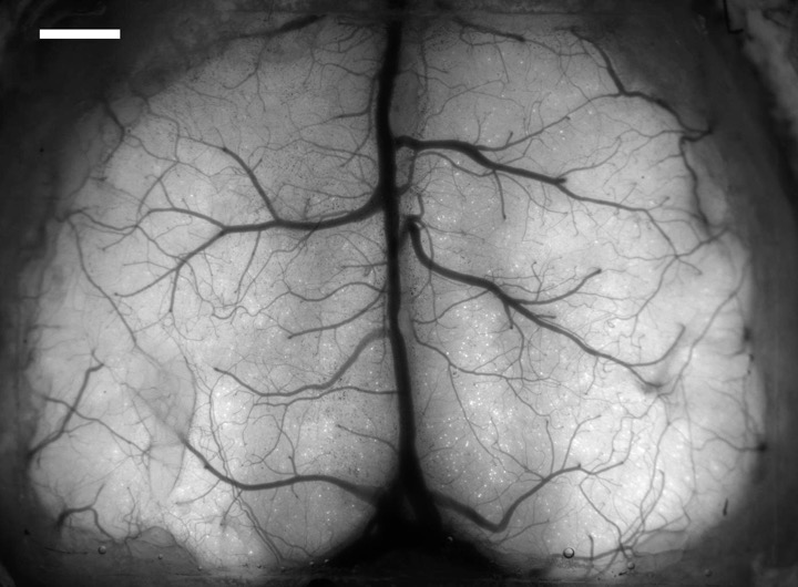 black and white brain scan