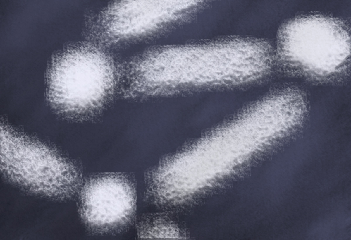 A close-up photograph of bacteria.