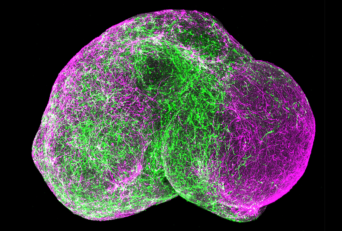 GABAergic neurons (green)