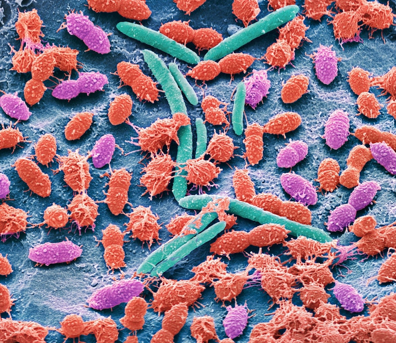 Scanning electron micrograph (SEM) of bacteria cultured from a sample of human faeces. The SEM shows a variety of different bacteria types.