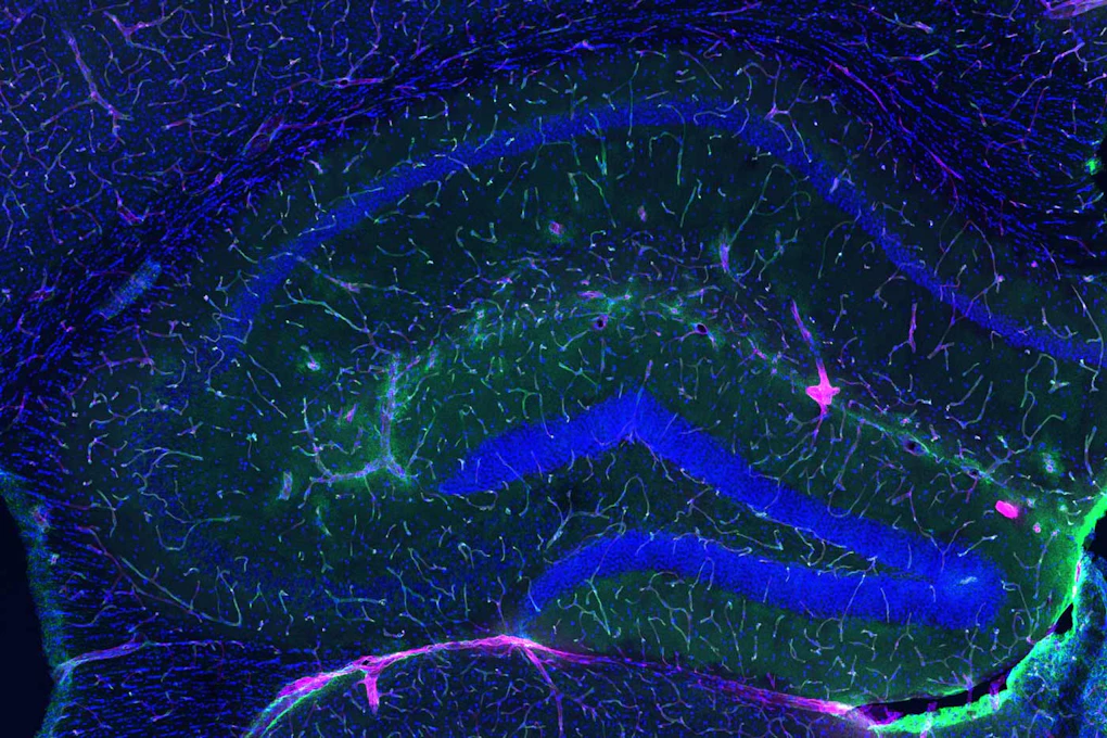 Brain scan showing a healthy blood-brain barrier preventing pink dye from leaking through it.