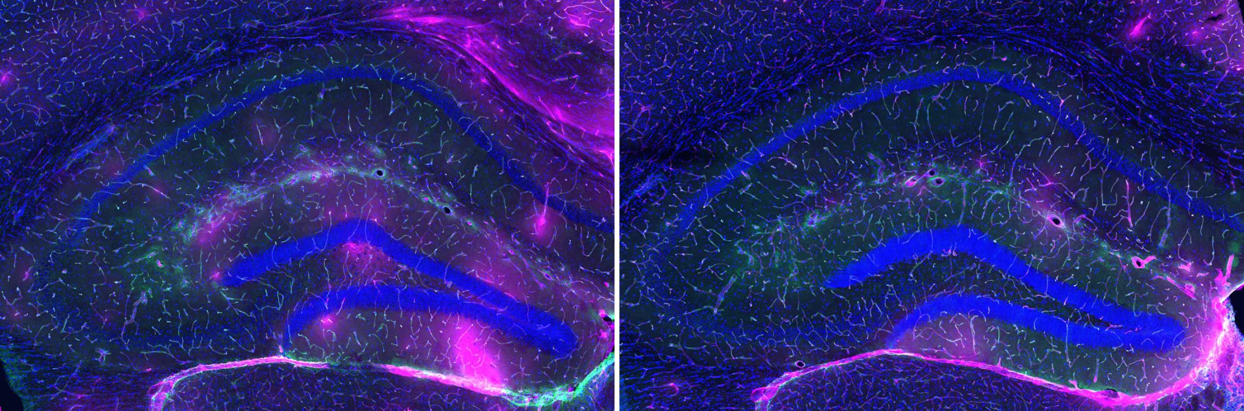 A Liver Enzyme Produced During Exercise Might Reverse Memory Loss