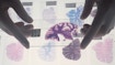 Brain slices. Gloved hands hold a microscope slide of a section through a human brain above an assortment of other brain sections on a lightbox. The slide being held up and the lower row of slides are coronal slices through the frontal region of the cerebrum. The cerebrum is the part of the brain involved with conscious thought and sensory processing. The other two rows of slides are sections through the cerebellum, which coordinates movement and balance. By examining brain slices under a microscope the health of the brain can be determined.