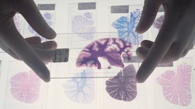 Brain slices. Gloved hands hold a microscope slide of a section through a human brain above an assortment of other brain sections on a lightbox. The slide being held up and the lower row of slides are coronal slices through the frontal region of the cerebrum. The cerebrum is the part of the brain involved with conscious thought and sensory processing. The other two rows of slides are sections through the cerebellum, which coordinates movement and balance. By examining brain slices under a microscope the health of the brain can be determined.