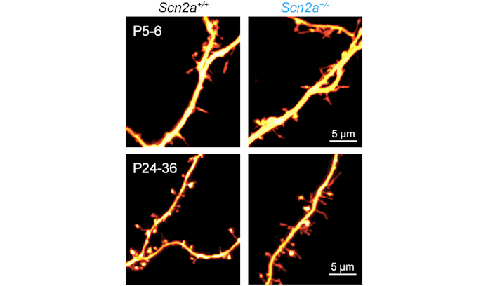 Image of dendrites of pyramidal neurons