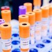 Test tubes for blood. Medical equipment. Multi-colored cover, a photo close up, shallow depth of field.