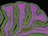 Cerebellum from a brain. Multiphoton fluorescence micrograph (MFM) of a section through the cerebellum from a human brain, showing the inner white matter (purple) and outer grey matter (green). The white matter mainly contains axons, which pass nerve impulses to the brain's outer cortex. The grey matter is made up of two layers of neurons (nerve cells), the molecular layer and the granular layer. Here, glial cells in the grey matter are stained green and cell nuclei in the white matter are stained purple. The cerebellum controls sensory perception, motor control and coordination. Magnification: x100 when printed at 10 centimetres across.