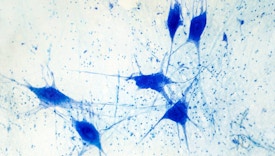 Light micrograph of human brain tissue showing neurons and glial cells