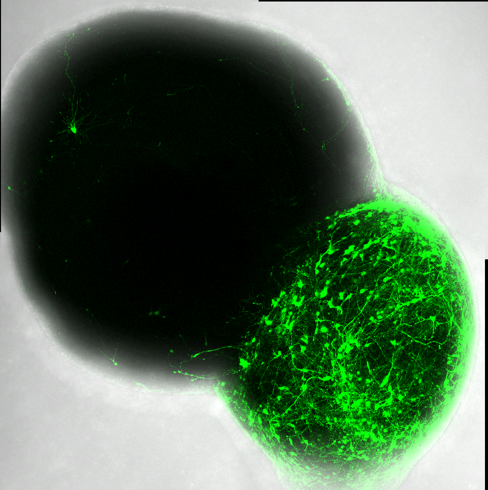 SFARI | Two Studies Using Brain Organoids Reveal Cell-type-specific ...