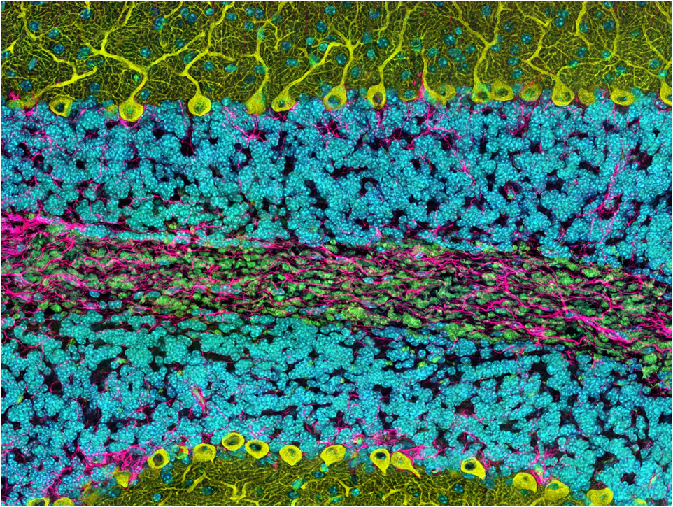 Image credit: Thomas Deerinck, NCMIR/ScienceSource