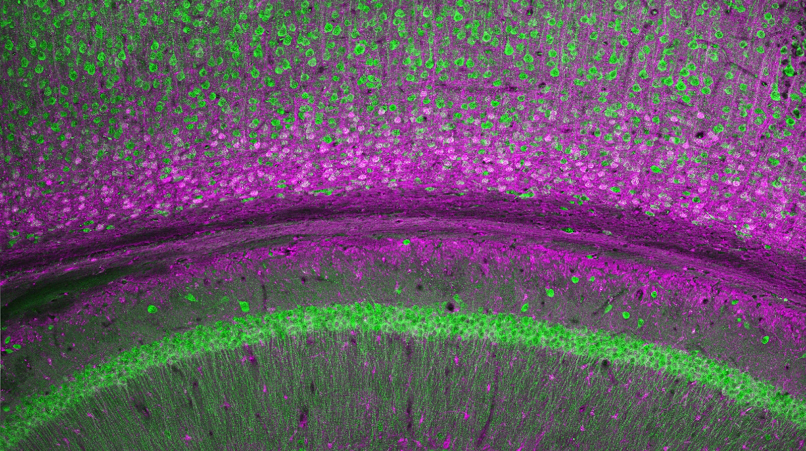 Microscope image of cellular layers in the hippocampus.