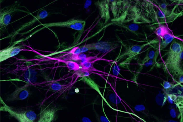 Photo of nerve cells in petri dishes. Neural wires have grown from the cells as they try to connect.