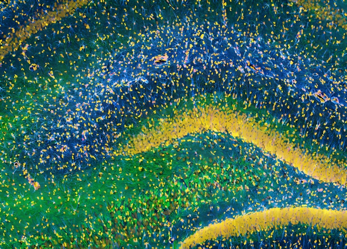 Image of the hippocampus was taken with an ultra-widefield high- speed multiphoton laser microscope.