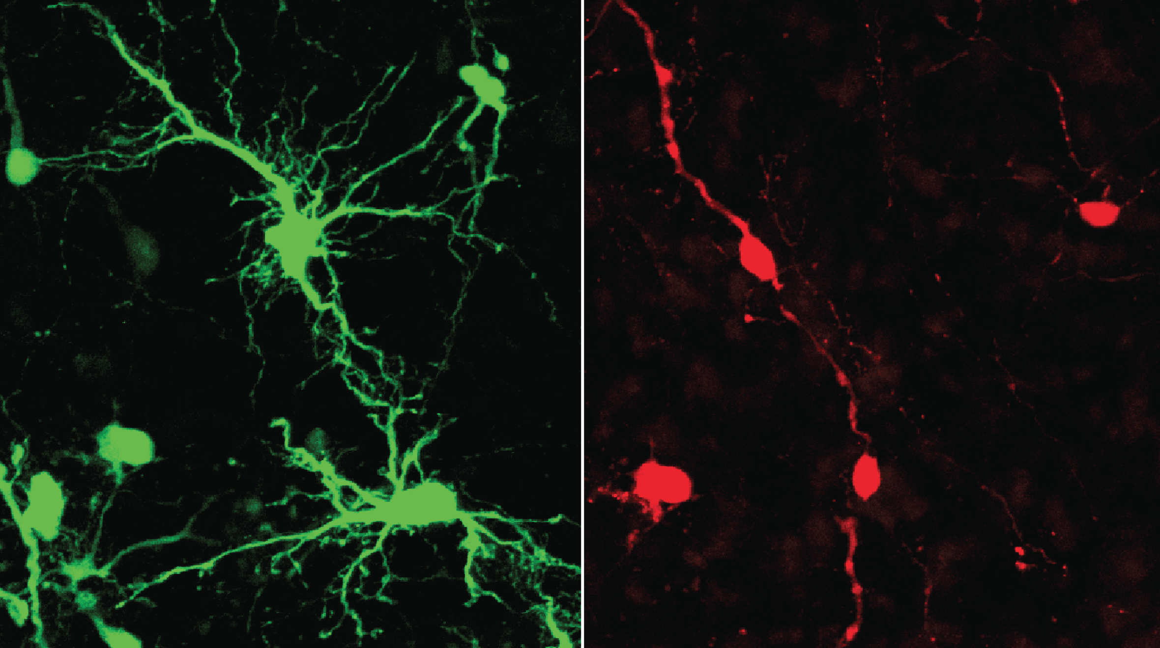 SFARI | Multimodal Approach Reveals How Autism-Linked Genes Shape ...