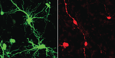 An image of control neurons in the dorsolateral prefrontal cortex of fetal macaque showing their many dendrites, compared to immature neurons that have few dendrites.