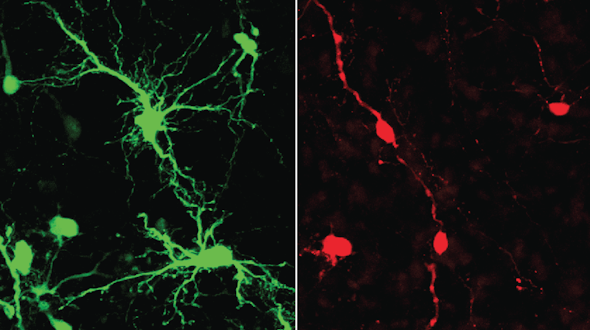 An image of control neurons in the dorsolateral prefrontal cortex of fetal macaque showing their many dendrites, compared to immature neurons that have few dendrites.