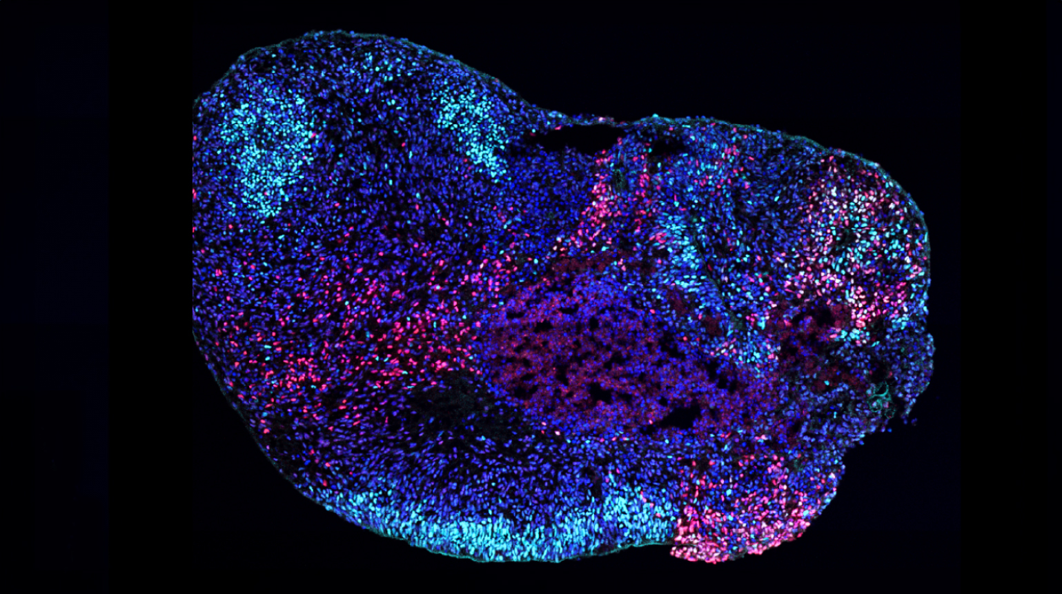 A microscopy image of a human stem cell-derived hippocampal organoid.