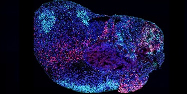 A microscopy image of a human stem cell-derived hippocampal organoid.