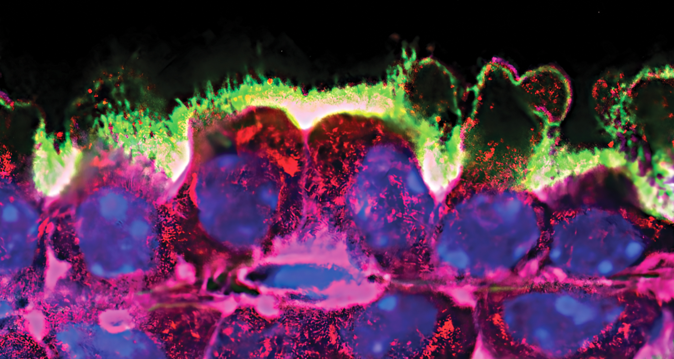 The choroid plexus undergoing apocrine secretion.